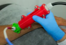 Investigadores de Medellín crearon un dispositivo para acelerar el tratamiento de la leishmaniasis. Foto/ITM