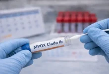 primer caso de viruela símica Clado Ib en Colombia. Foto/Universidad Ces