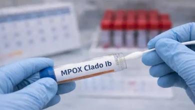 primer caso de viruela símica Clado Ib en Colombia. Foto/Universidad Ces