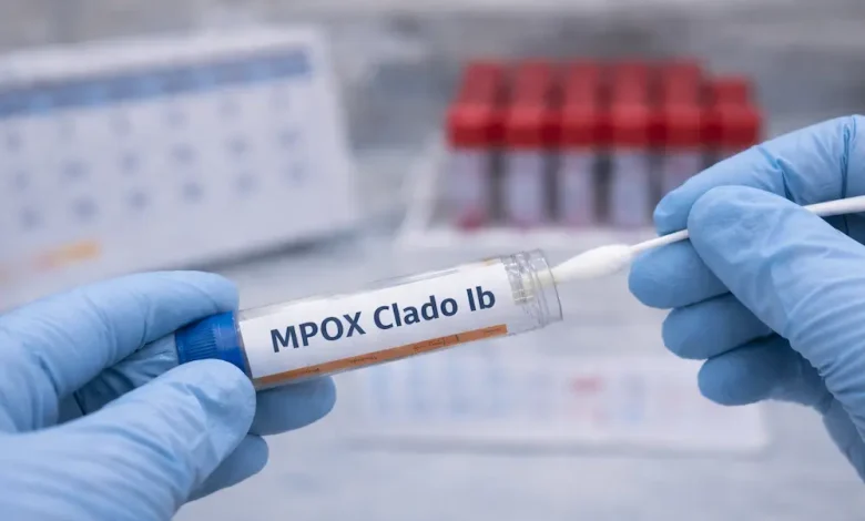 primer caso de viruela símica Clado Ib en Colombia. Foto/Universidad Ces